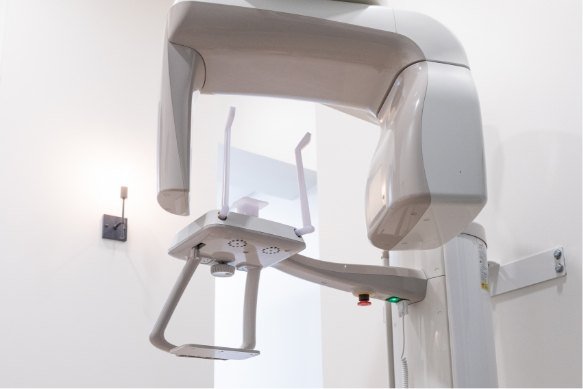 3 D C T cone beam digital x ray scanner