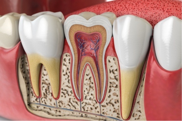 Animated inside of tooth used to explain pulp therapy