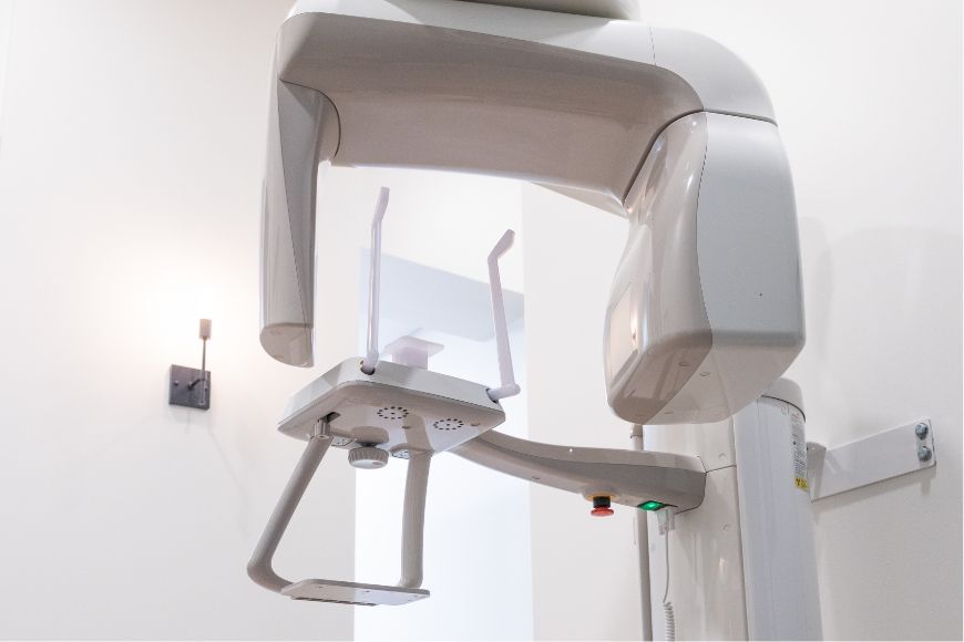 3 D C T cone beam digital x ray scanner